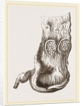Stomach of Adjutant by Anonymous