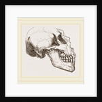 Skull of Human Idiot by Anonymous