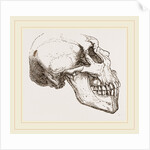 Skull of Human Idiot by Anonymous