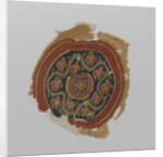 Tissue Fragment with orbiculus by Anonymous