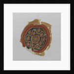 Tissue Fragment with orbiculus by Anonymous