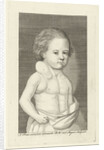 Boy with a tumor by Pieter Willem van Megen