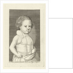 Boy with a tumor by Pieter Willem van Megen