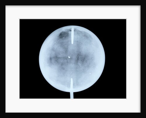 Globe x-ray by John Cary