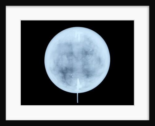 Globe x-ray by John Miller