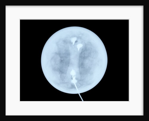 Globe x-ray by West