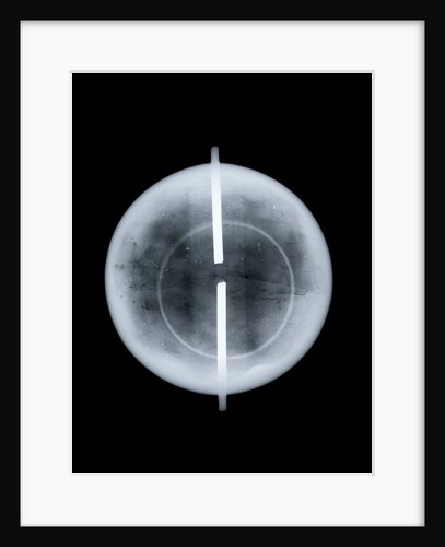 Globe x-ray by West