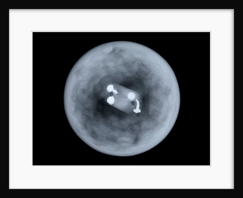 Globe x-ray by Charles Price