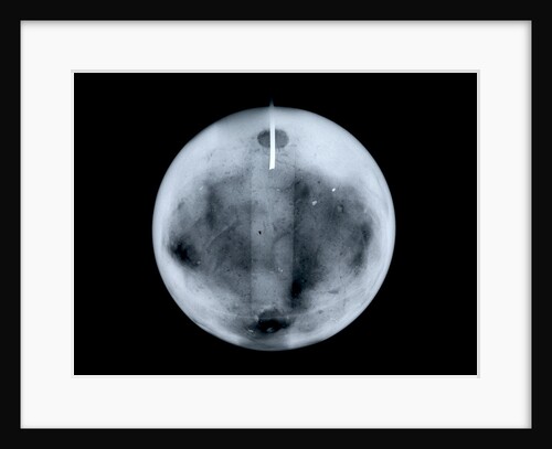 Globe x-ray by George Adams