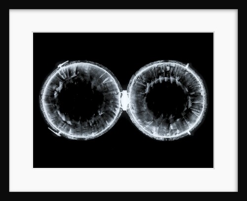 Globe x-ray by Nicolas Lane