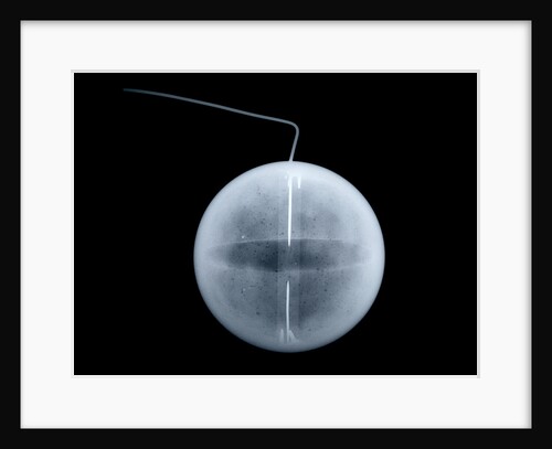Globe x-ray by William Palmer