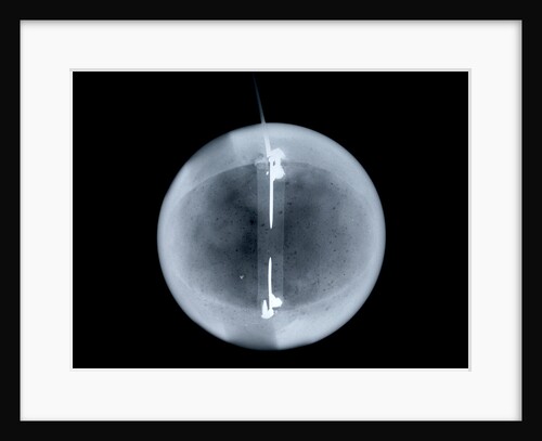 Globe x-ray by William Palmer