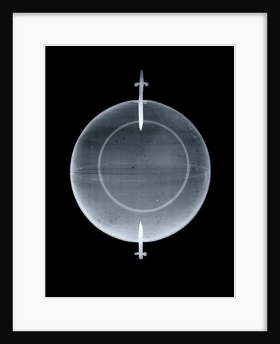 Globe x-ray by Jean Fortin