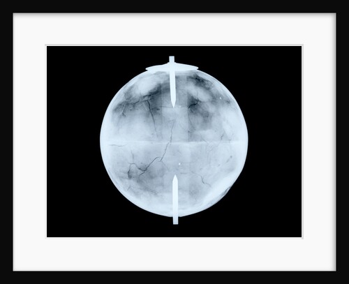 Globe x-ray by Dudley Adams