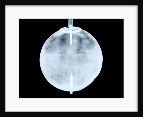 Globe x-ray by Dudley Adams