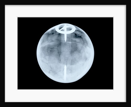 Globe x-ray by Dudley Adams