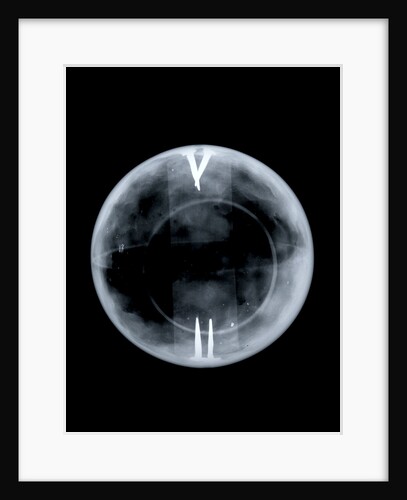 Globe x-ray by Richard Cushee