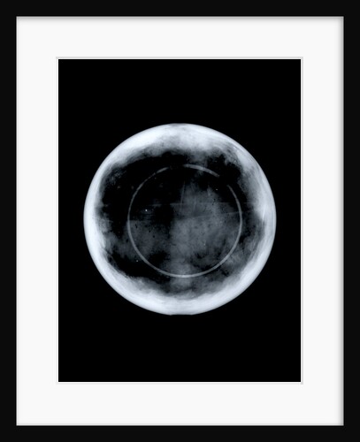 Globe x-ray by George Adams
