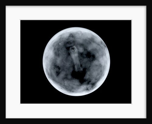 Globe x-ray by James Ferguson