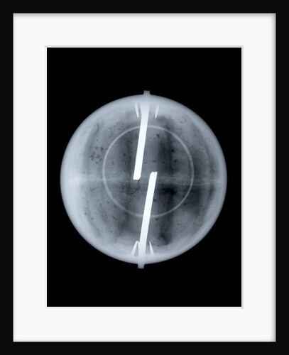 Globe x-ray by Newton & Co.