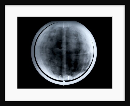Globe x-ray by Johann Gabriel Doppelmayr