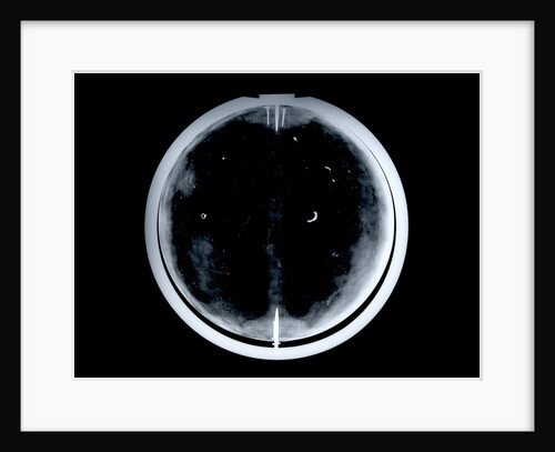 Globe x-ray by Johann Gabriel Doppelmayr