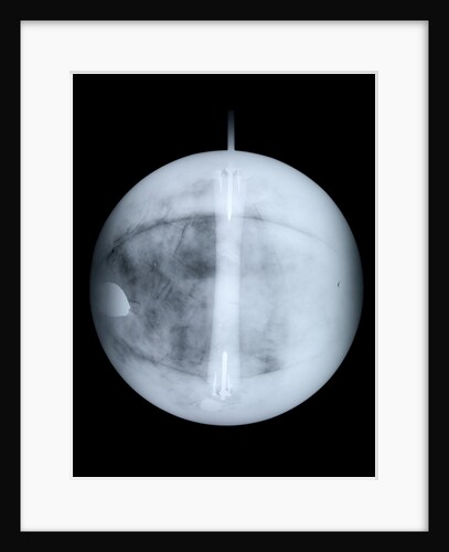 Globe x-ray by Benjamin Martin