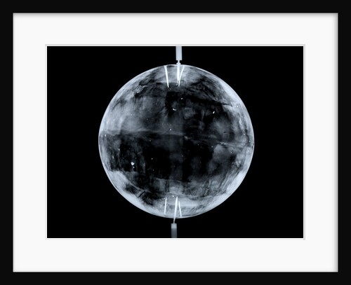 Globe x-ray by Johann Gabriel Doppelmayr