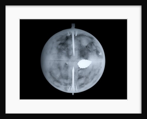 Globe x-ray by Nathaniel Hill