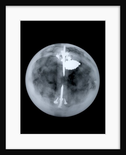 Globe x-ray by Nathaniel Hill