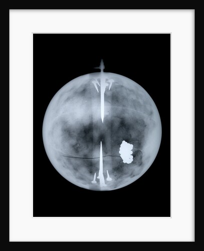 Globe x-ray by Nathaniel Hill