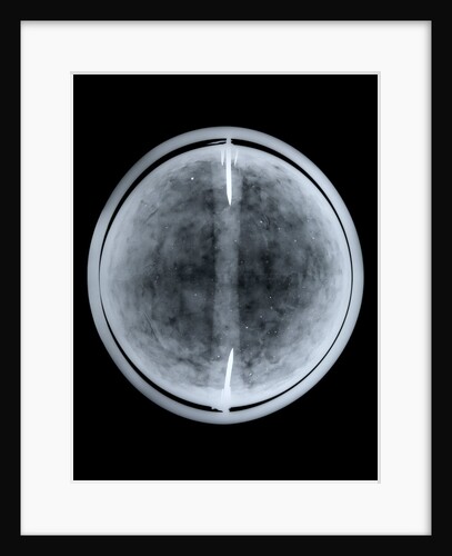 Globe x-ray by William Bardin