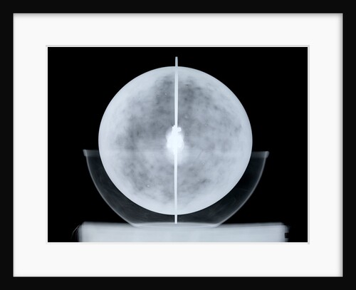 Globe x-ray by William Bardin
