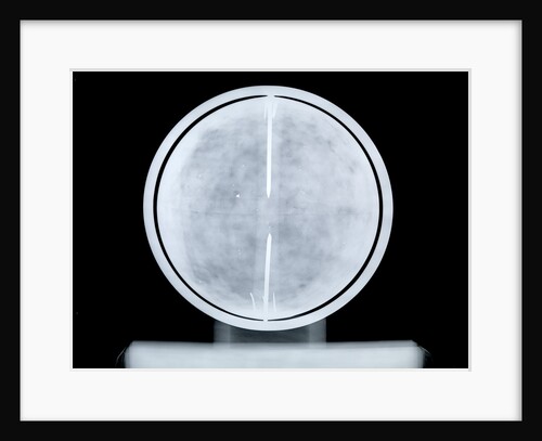 Globe x-ray by William Bardin