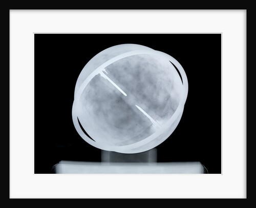Globe x-ray by William Bardin