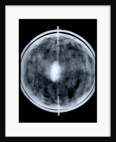 Globe x-ray by Jacob Floris van Langren