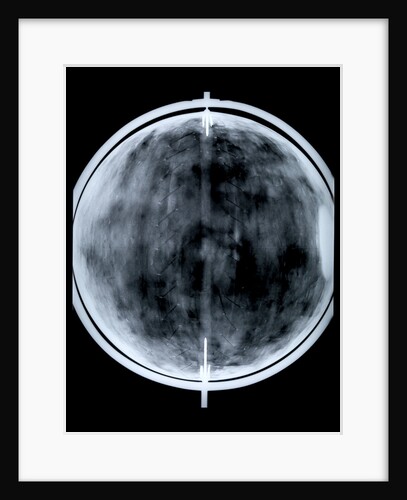 Globe x-ray by Jacob Floris van Langren