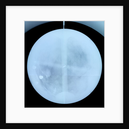 Globe x-ray by Gerard Valk