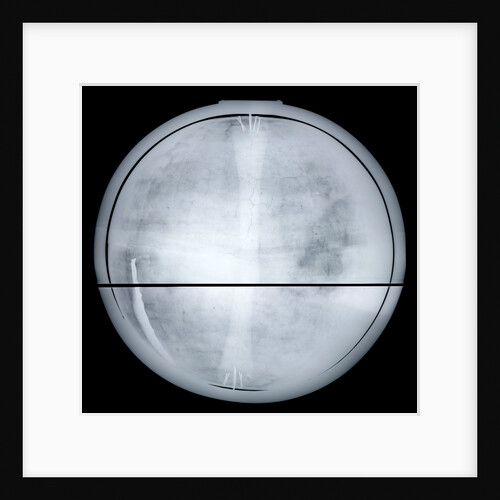 Globe x-ray by Jean Antoine Nollet