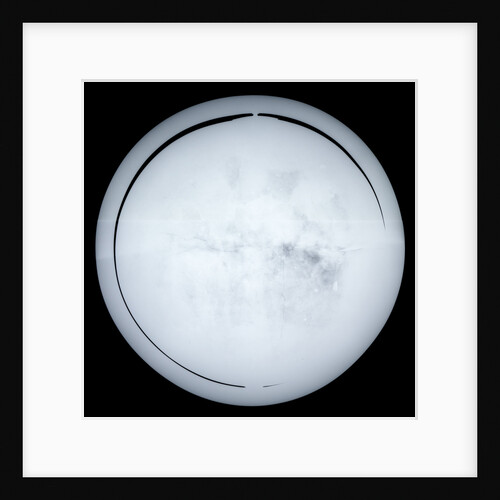Globe x-ray by Hyacinthe Langlois