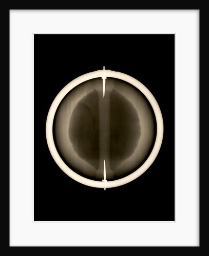 Globe x-ray by Joannes Oterschaden