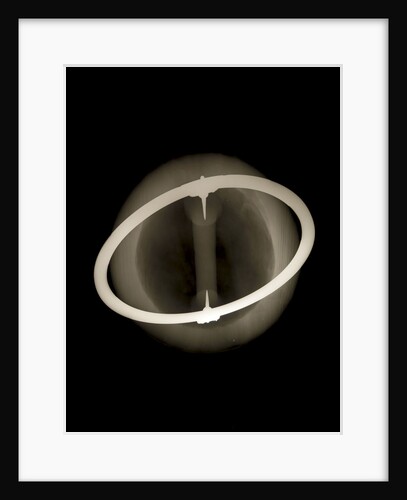 Globe x-ray by Joannes Oterschaden