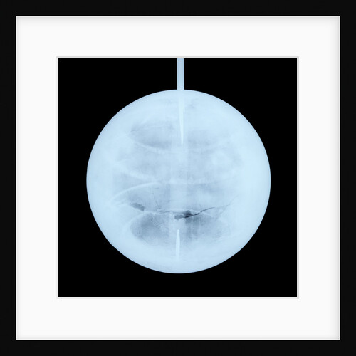 Globe x-ray by Peter Anich