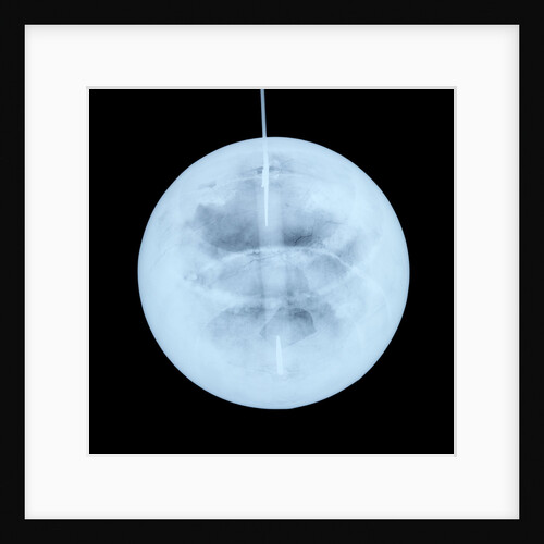 Globe x-ray by Peter Anich