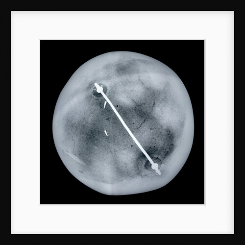 Globe x-ray by Gemma Frisius