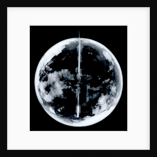 Globe x-ray by unknown