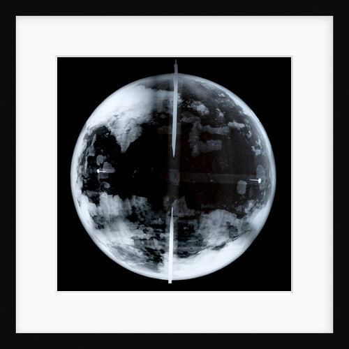 Globe x-ray by unknown