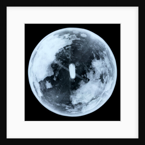 Globe x-ray by unknown