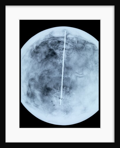 Globe x-ray by Giovanni Maria Cassini