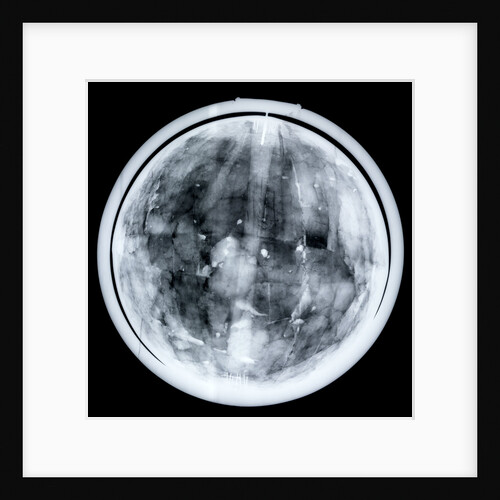 Globe x-ray by Jacques Hardy